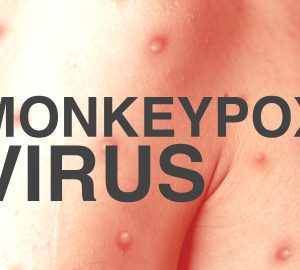 Monkeypox Virus symptoms treatment